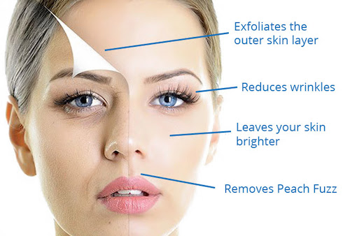 Dermaplaning procedure