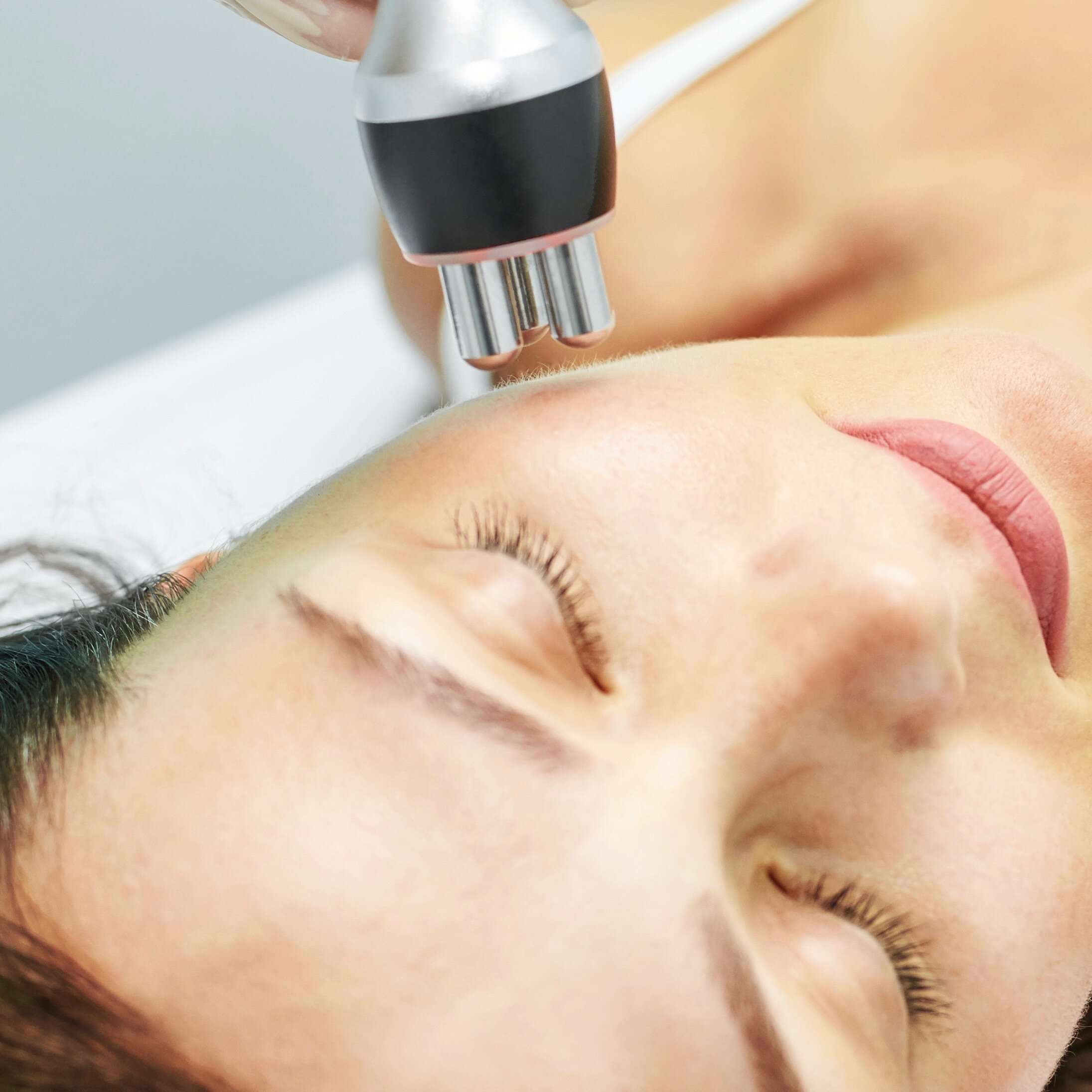 Skin Tightening Radiofrequency